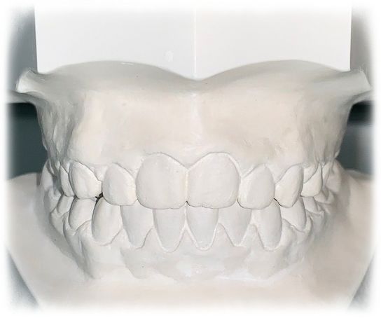 Kieferorthopädie von Dental-Ästhetik Center Dr. med. dent. Uwe Lucas in Schüttorf