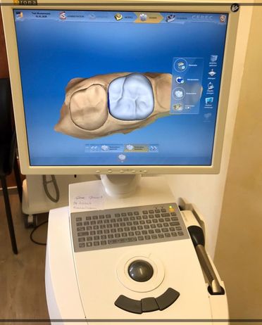Cerec 3 D von Dental-Ästhetik Center Dr. med. dent. Uwe Lucas in Schüttorf